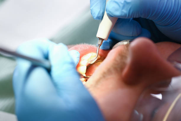 Best Emergency Treatment for Jaw Pain or Injury in Sinton, TX