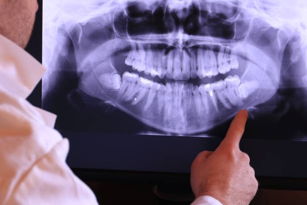 Best Emergency Care for Gum Disease in Sinton, TX