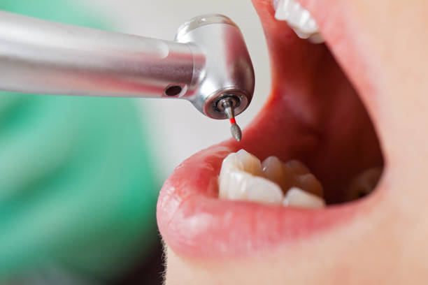 Best Emergency Root Canal Therapy in Sinton, TX